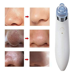 Aspirateur Point Noir Nettoyeur Visage Acné