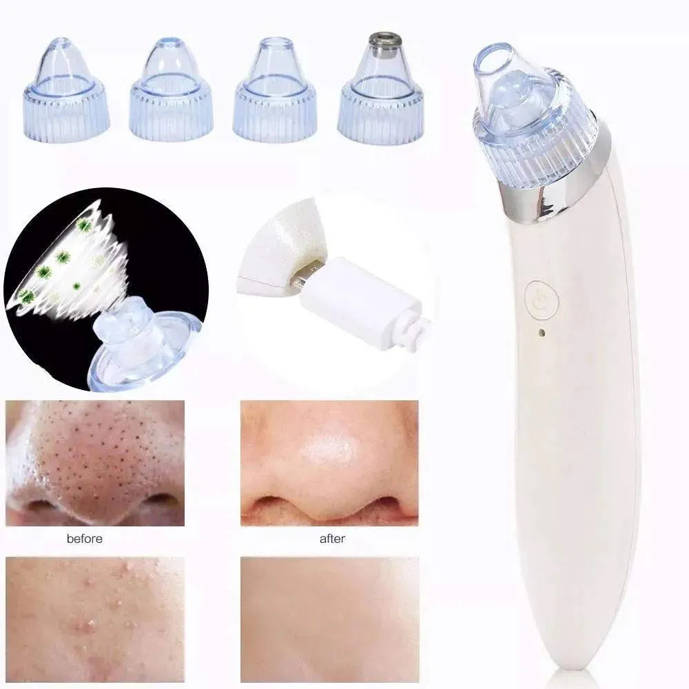 Aspirateur Point Noir Nettoyeur Visage Acné